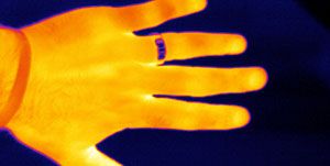 image.jpg?width=300&quality=80